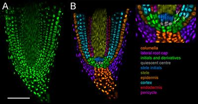 A Toolkit for High Resolution Imaging of Cell Division and Phytohormone Signaling in Legume Roots and Root Nodules